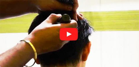 Hair Transplant Abroad - Sydney Hairdressers 4