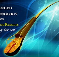 Hairgen Hair Loss Control Centre - Sydney Hairdressers